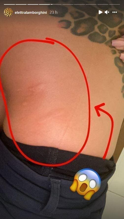 Elettra Lamborghini morso