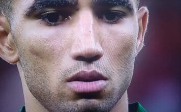 Hakimi